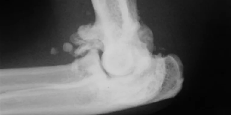 Arthritis in a cat as it appears under x-ray